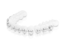 ortodoncia con brackets